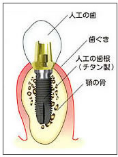 ロゴを挿入